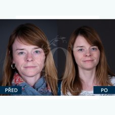 SKINSUPERFOOD antiaging olej pro suchou pleť, 10 ml SKINSUPERFOOD antiaging olej pro suchou pleť, 10 ml