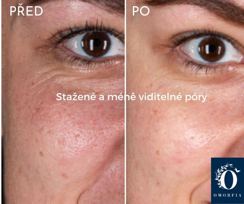 ZEN PURITY odličovací a čistící balzám
