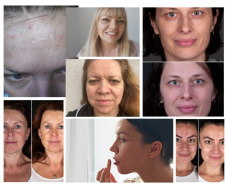 SKIN COACHING SKIN COACHING