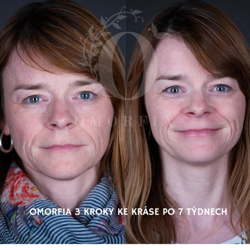SKINSUPERFOOD antiaging olej pro suchou pleť